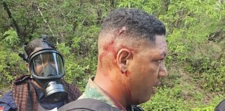 Tres policías y un capitán del Ejército resultan heridos tras agresión a pedradas en protesta en San Juan de la Maguana
